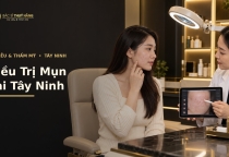 Điều Trị Mụn Tại Tây Ninh – Giải Pháp Cho Mụn Viêm, Mụn Tái Phát