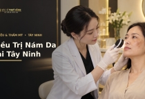 Điều Trị Nám Da Tại Tây Ninh – Thăm Khám Và Lựa Chọn Phương Pháp Phù Hợp