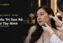 Điều Trị Sẹo Rỗ Tại Tây Ninh – Phương Pháp, Quy Trình Và Chi Phí