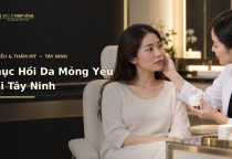 Phục Hồi Da Mỏng Yếu Tại Tây Ninh – Chăm Sóc Da Sau Kích Ứng