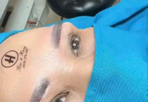 TRẢ LẠI ĐÔI MẮT THANH XUÂN – NHẸ NHÀNG & TỰ NHIÊN CÙNG BS PHẠM THÚY HẰNG