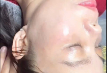 Spa Trị Nám Hiệu Quả Uy Tín Tại Tây Ninh – Giải Pháp Phục Hồi Da An Toàn