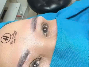 TRẢ LẠI ĐÔI MẮT THANH XUÂN – NHẸ NHÀNG & TỰ NHIÊN CÙNG BS PHẠM THÚY HẰNG