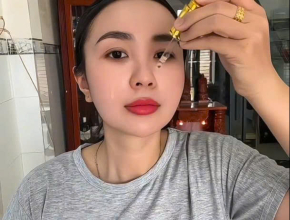 Bác Sĩ Chuyên Khoa I Nói Gì Sau Khi Điều Trị Nám Tại Bác Sĩ Hằng? | Xem Hết Clip Để Biết Sự Thật! 