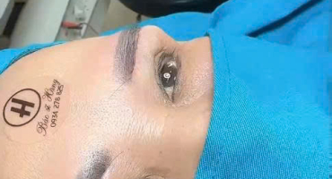 TRẢ LẠI ĐÔI MẮT THANH XUÂN – NHẸ NHÀNG & TỰ NHIÊN CÙNG BS PHẠM THÚY HẰNG