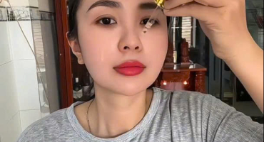 Bác Sĩ Chuyên Khoa I Nói Gì Sau Khi Điều Trị Nám Tại Bác Sĩ Hằng? | Xem Hết Clip Để Biết Sự Thật! 