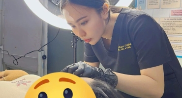 Tiêm Môi + Tiêm Cằm Không Bầm Không Sưng – Giải Pháp Nâng Tầm Nhan Sắc Tự Nhiên Chuẩn Y Khoa