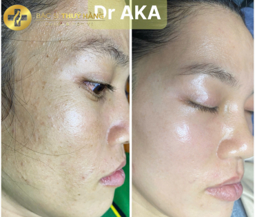 DỊCH VỤ CHĂM SÓC & ĐIỀU TRỊ DA MỤN