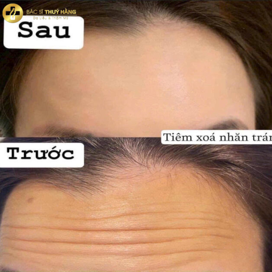 Test dịch vụ 4