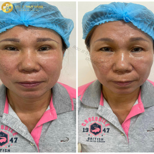 Test dịch vụ 1
