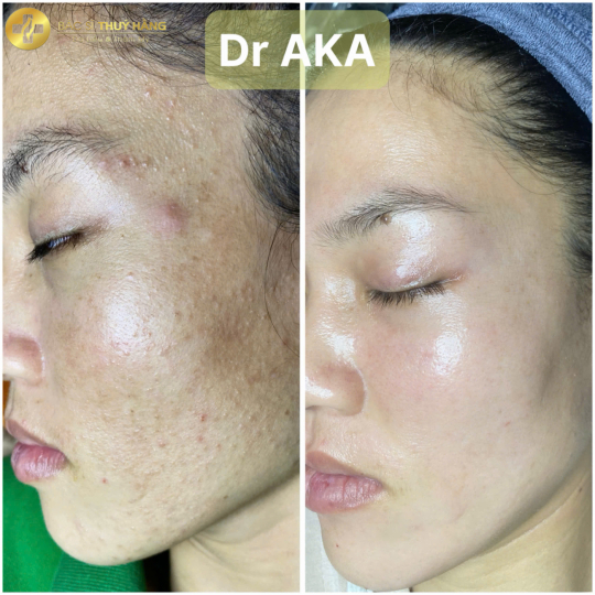 DỊCH VỤ CHĂM SÓC & ĐIỀU TRỊ DA MỤN