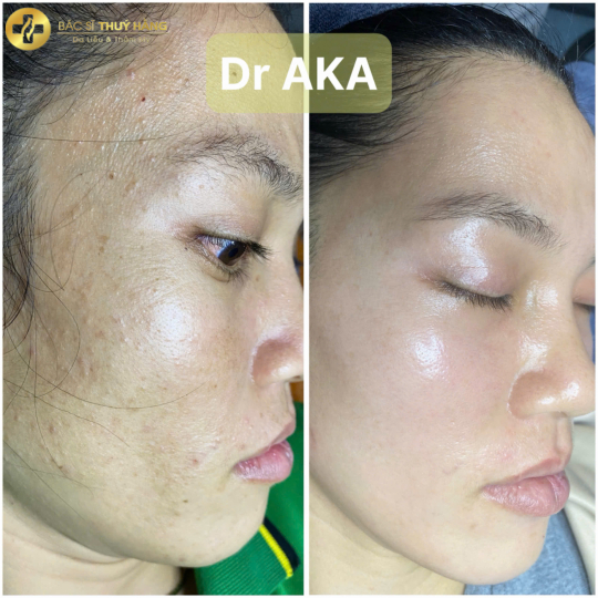 DỊCH VỤ CHĂM SÓC & ĐIỀU TRỊ DA MỤN