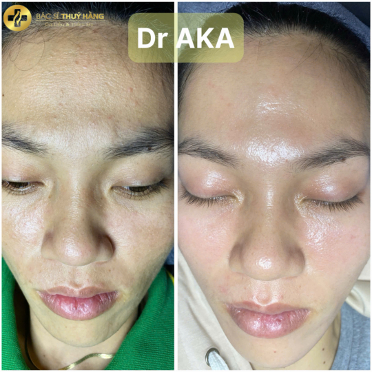 DỊCH VỤ CHĂM SÓC & ĐIỀU TRỊ DA MỤN